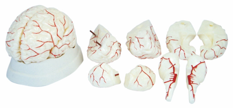Brain With Arteries XC-308