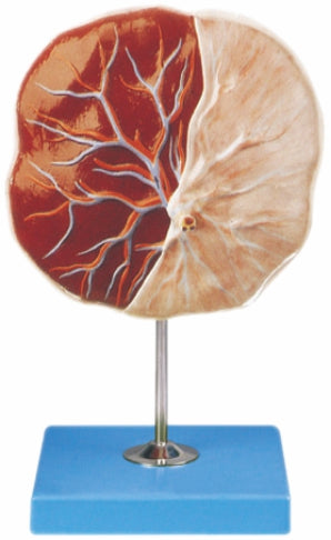Human Placenta GDA42010/1