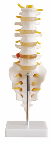 Lumbar Vertebrae Sacrum & Coccyx &Herniated Disc XC-119