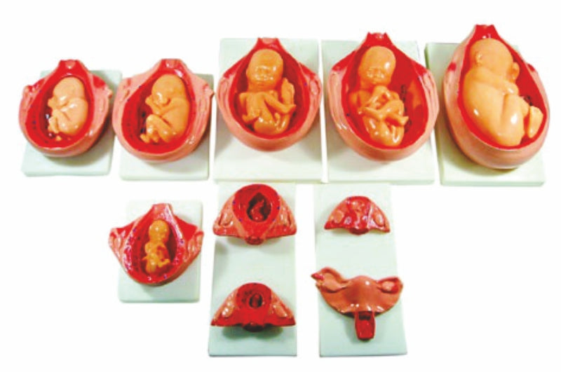 The Development Process For Fetus XC-414